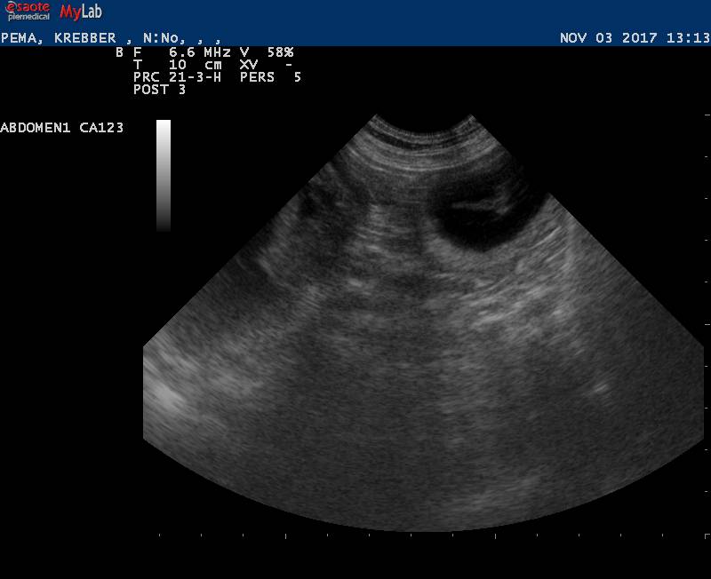 Ultraschall Do Khyi Hündin Od Chan Ma Pema
